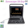 Factory direct sales best sonoscape ultrasonido obstetrico S8EXP