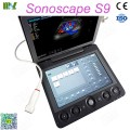 ecografie transfontanelara SonoScape S9 | ecografie doppler