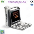 Sonoscape ultrasound sonoscape a6 precio: ultrasonido obstetrico