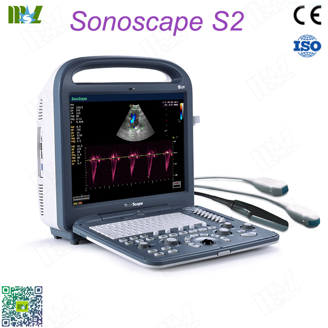SonoScape S2