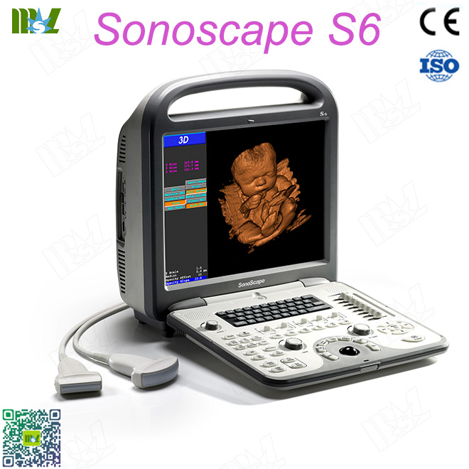 sonoscape ultrasound